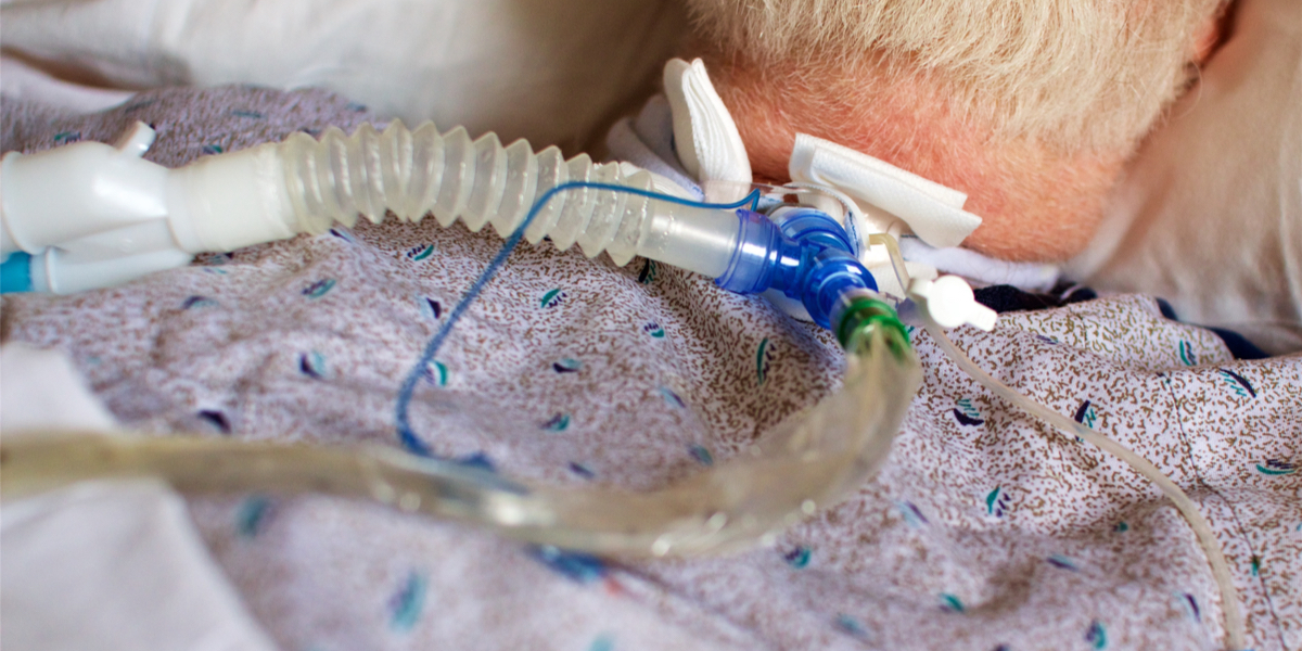 Life Expectancy Of ALS Patient On Ventilator